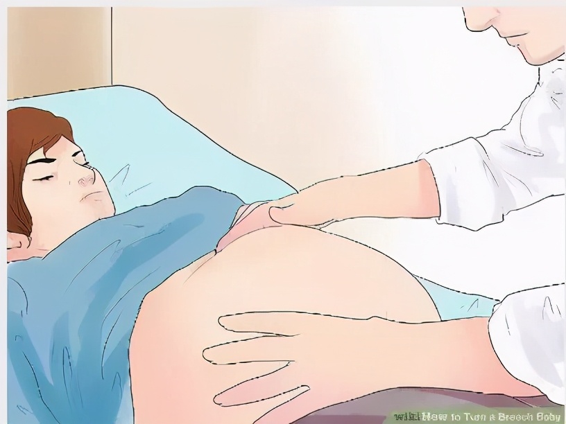 胎位不正医生徒手调胎位视频,胎儿胎位不正助产士帮忙调整胎位