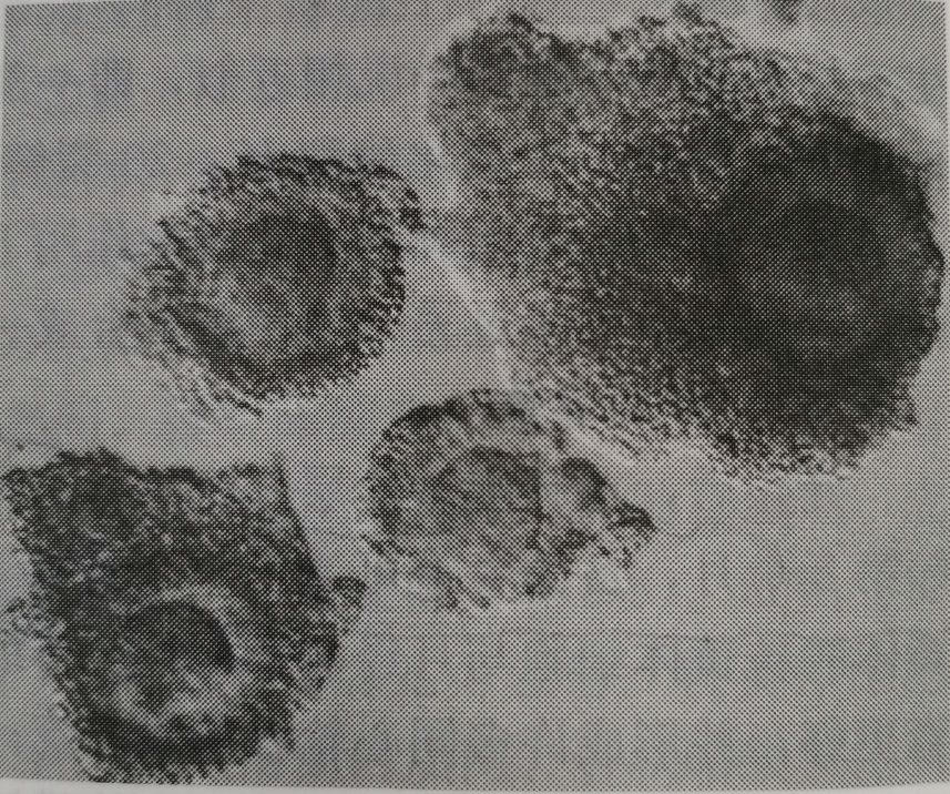 卵泡标准图片大全,微观卵泡是什么样子