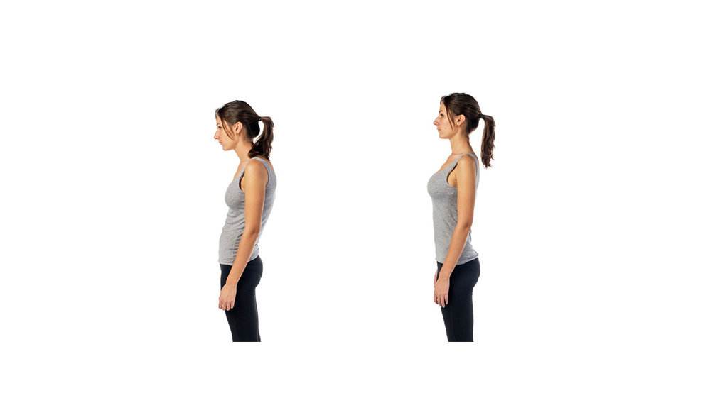 骨科大夫教你改善驼背,驼背的人如何矫正脊椎弯曲