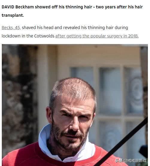 贝克汉姆快秃了,贝克汉姆为什么剃光头都那么帅