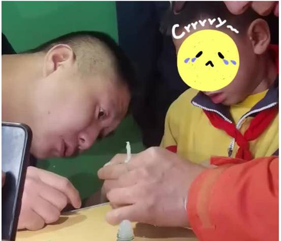 用502胶粘人事故,两小伙被502胶水粘住了