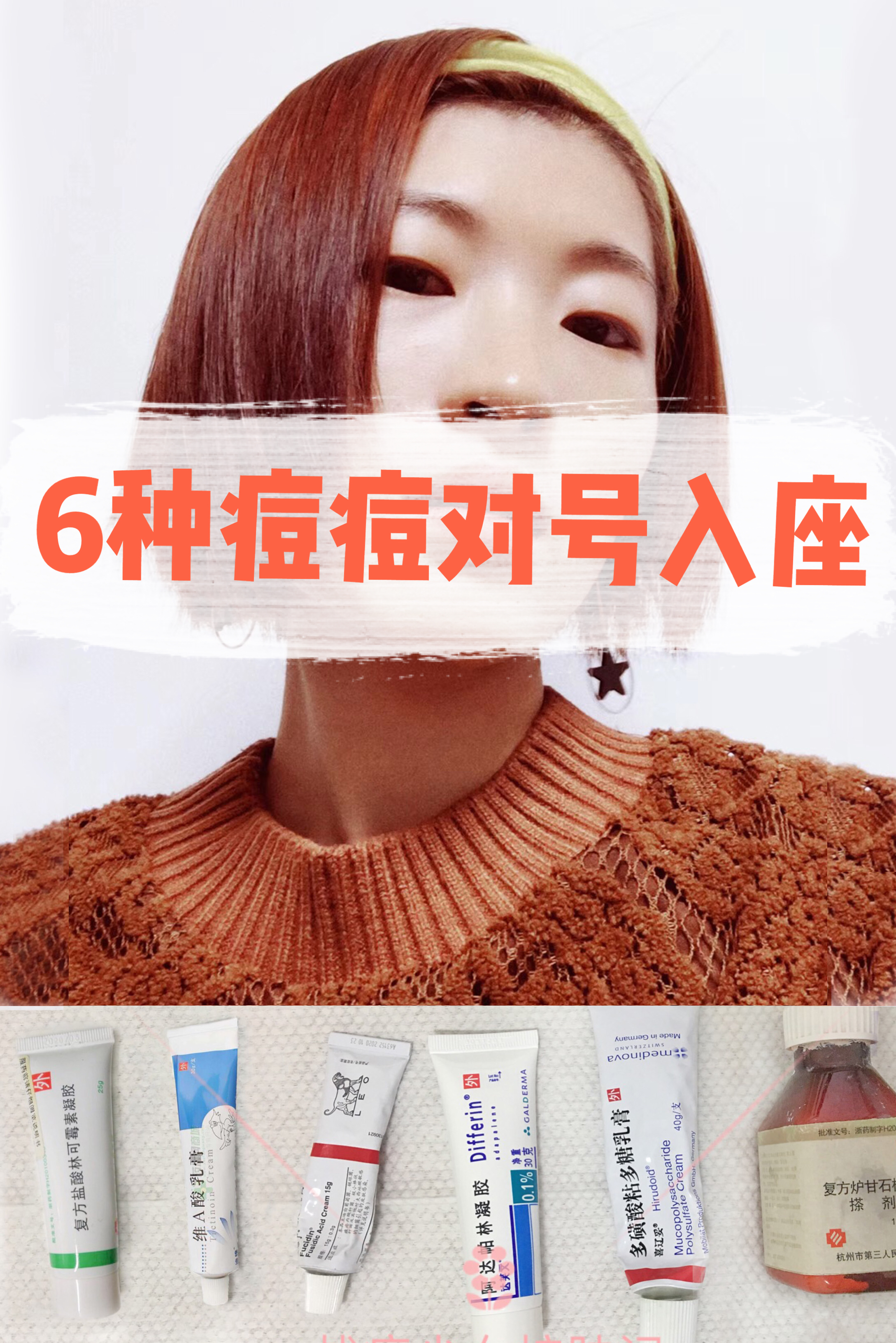 四招解决痘痘及痘痘的成因,痘痘不同原因类型及处理方法