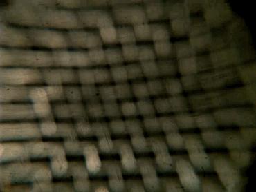 孩子膀胱容量130,儿童最大膀胱容量197正常吗