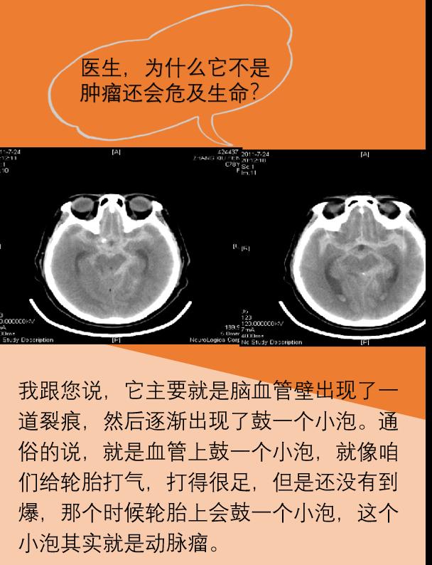 颅内动脉瘤属于主动脉瘤吗严重吗,脑动脉瘤和颅内动脉瘤是一回事吗