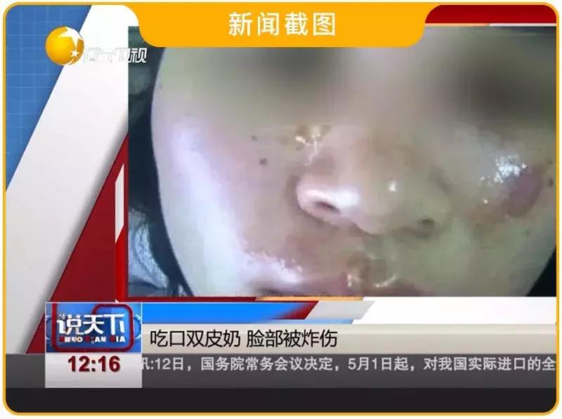 微波炉背面辐射大还是侧面辐射大,微波炉的辐射会对人体导致伤害吗