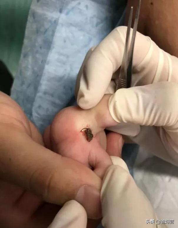 妈妈一拍小孩差点毁容,妈妈拍到孩子的恐怖画面