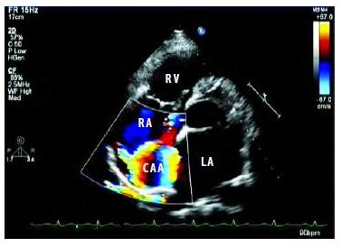 超声的未来,超声设备的发展趋势