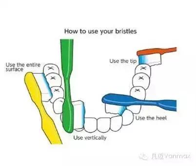 怎么刷牙才能去除牙菌斑,防止牙菌斑正确刷牙方法
