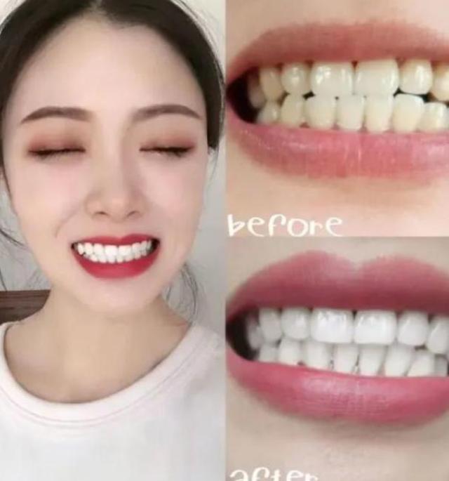 电动牙刷与普通牙刷的泡沫,用电动牙刷刷牙时怎么刷