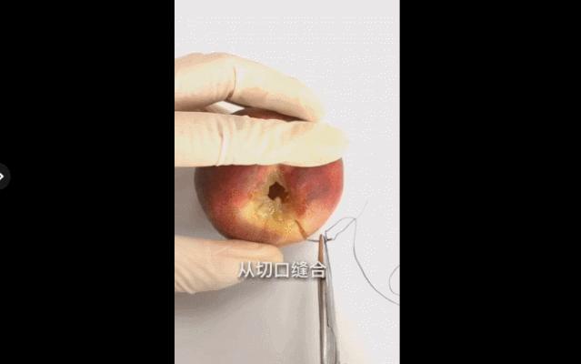 顺产侧切会不会留下后遗症？真相是？