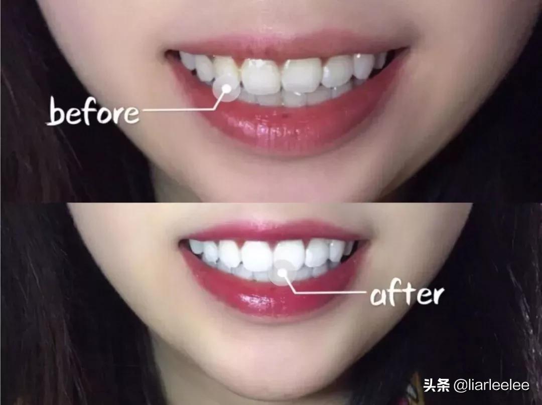 最好用的牙膏排行榜前十名,选哪个牌子的牙膏最安全好用