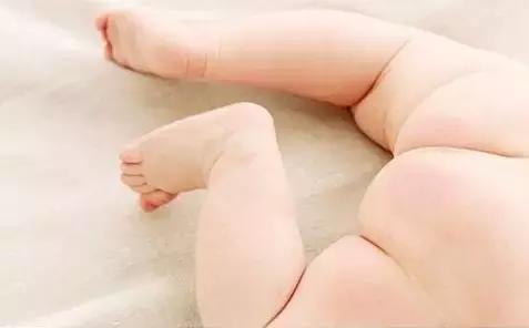 女童穿衣太潮患上妇科病,一岁女宝宝得了妇科病