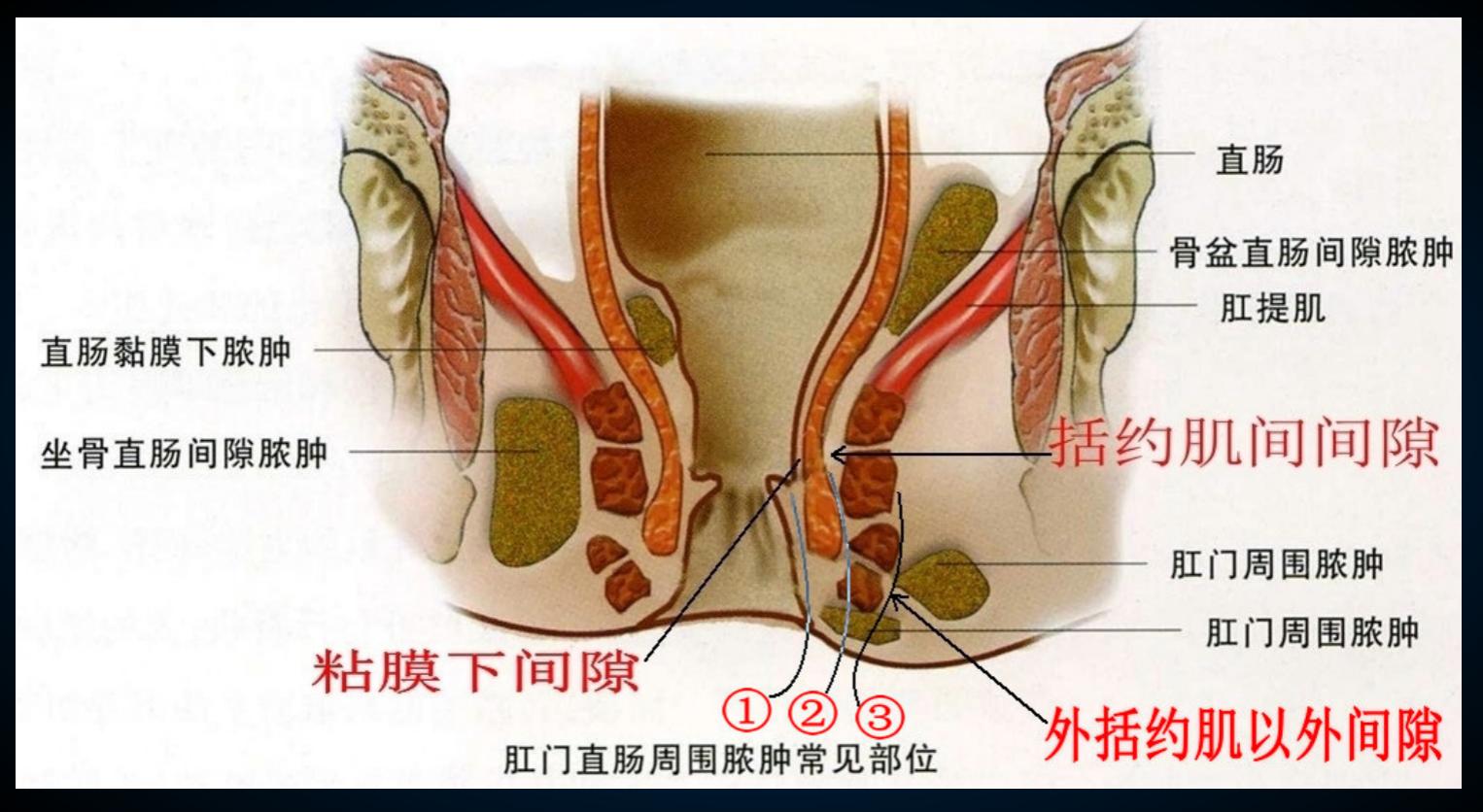 鑲涘懆鑴撹偪鐢ㄦ墜鏈悧,鍋氬畬鑲涘懆鑴撹偪鎵嬫湳