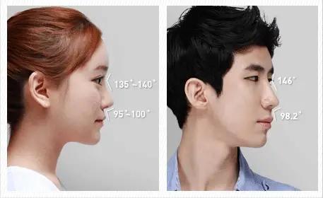 比较自然的隆鼻方式有哪些,哪种隆鼻方式最不容易歪