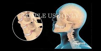 经常头痛与颈椎有关系吗如何改善,颈椎痛偏头痛按哪里