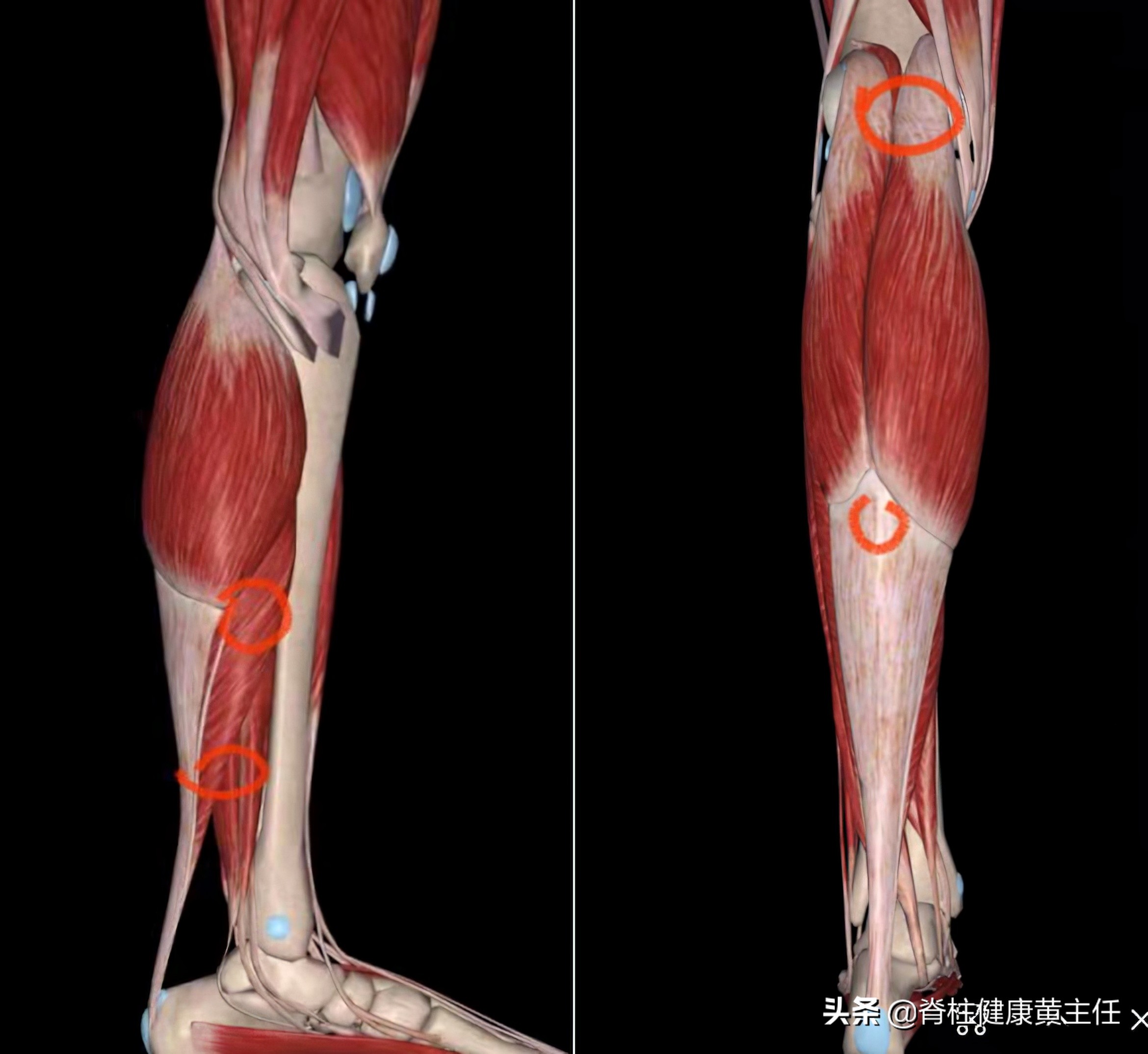 踝关节扭伤脱位手法复位视频,踝关节扭伤手法复位多久可以运动