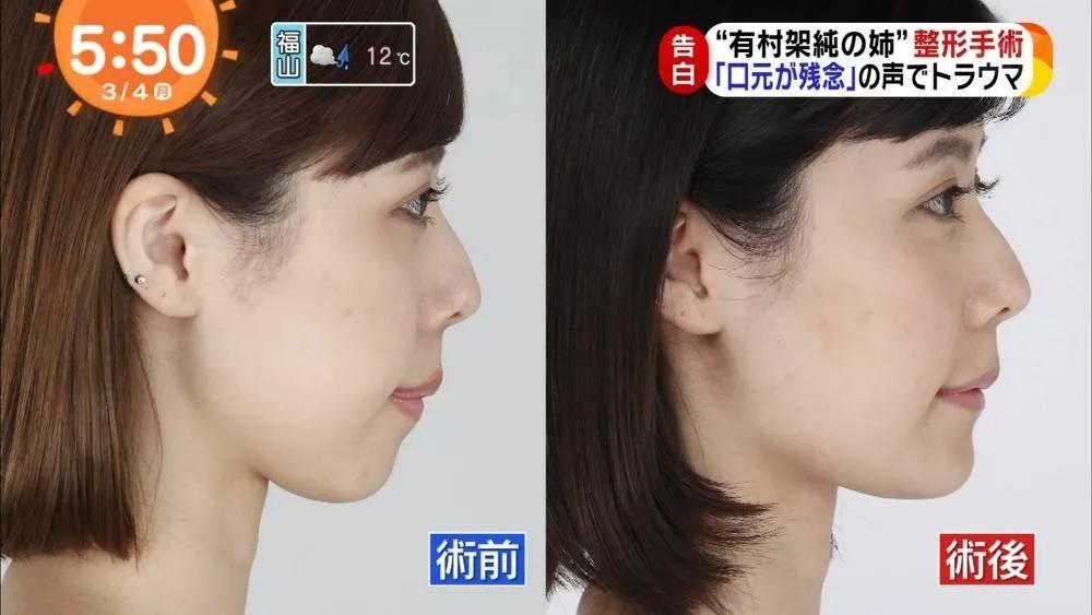 整容最成功的美人,整容最成功的13个人