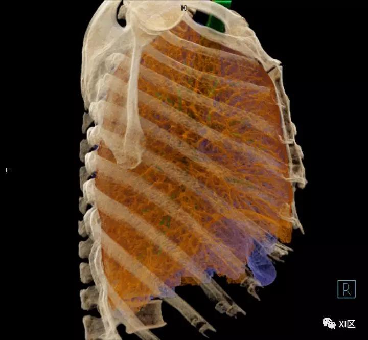 如此详细的肺部影像解剖，有点儿酷