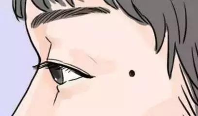 黑痣要去掉吗？专家和你聊聊关于“黑痣”的那些事儿