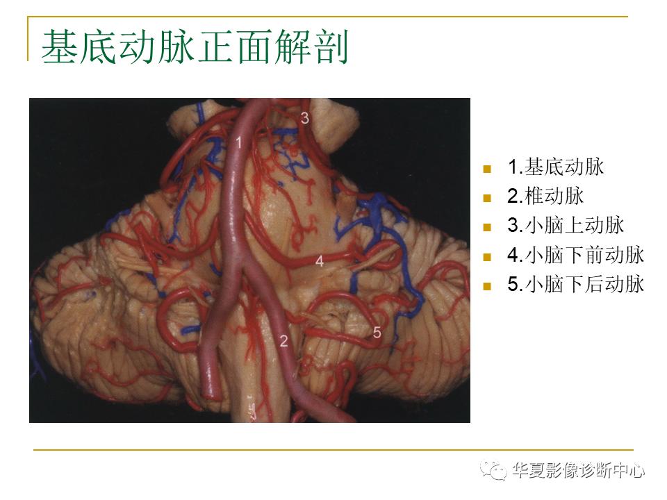 中国人脑立体定向mri应用解剖图谱,脑mri示意图