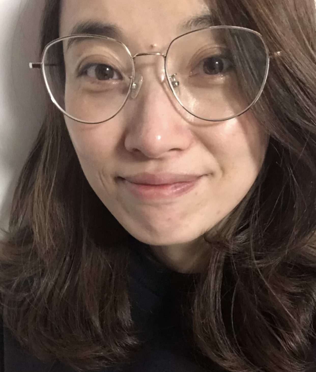 一笑眼下就有皱纹怎么办,从脸部看皱纹怎么才算老