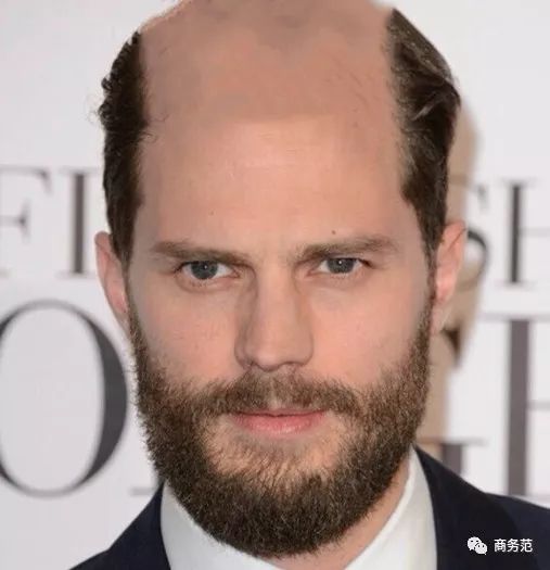 威廉王子秃顶了哈里为啥没秃顶,威廉王子为什么喜欢秃顶