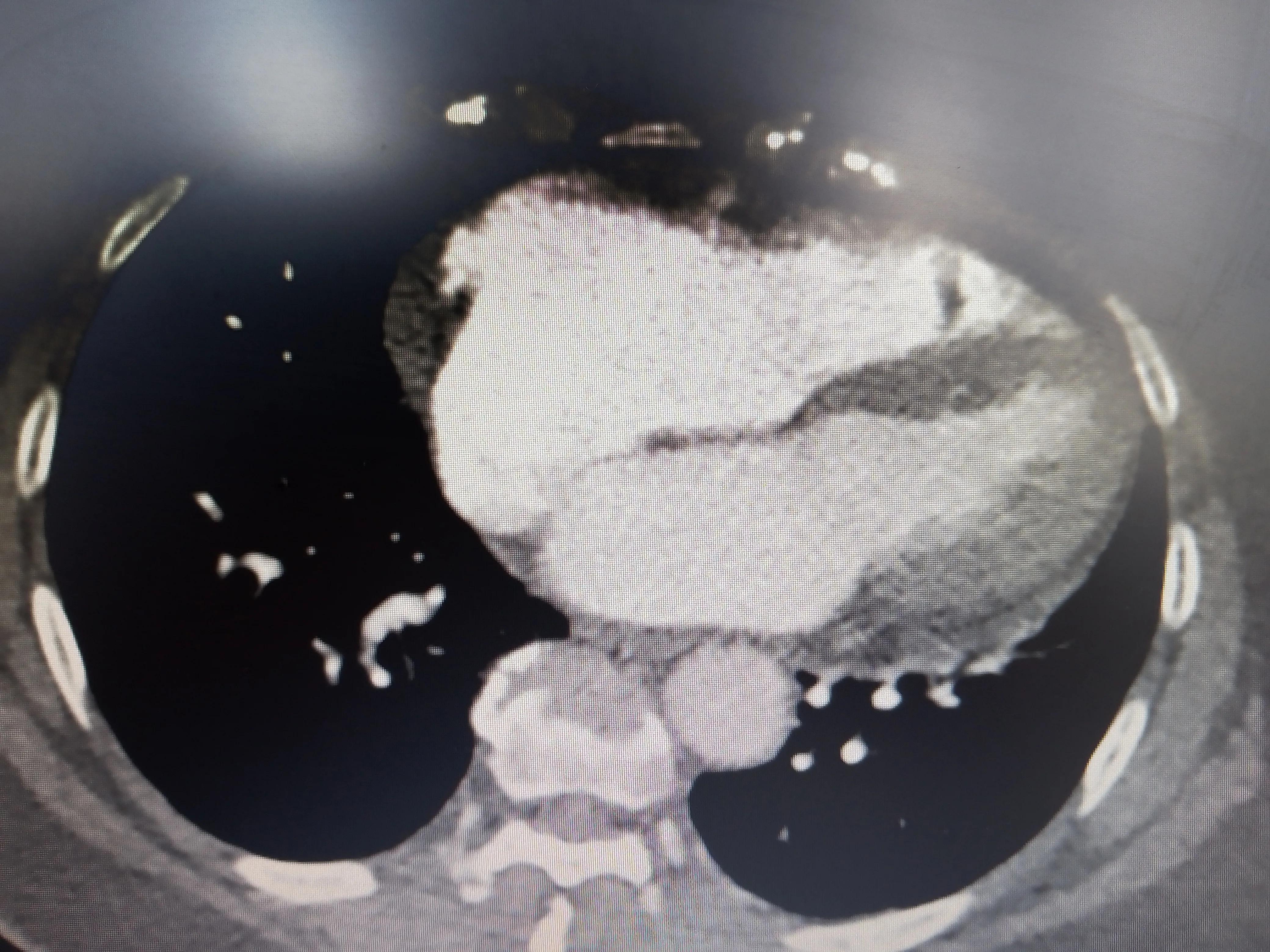 心血管病人吃伟哥,心血管病人可以用伟哥吗