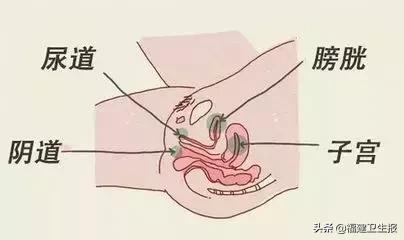 福建女子度完蜜月后出现尿频尿急，竟是患上这病！国庆节刚结婚的要注意了！