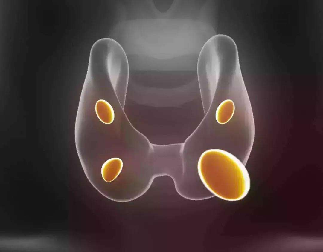 导致脱发真正的原因是什么,常见的引起脱发的原因有哪些