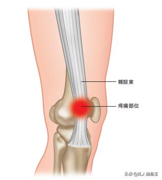 关于膝盖疼痛的原因和治疗,了解膝盖疼痛的最佳治疗方法