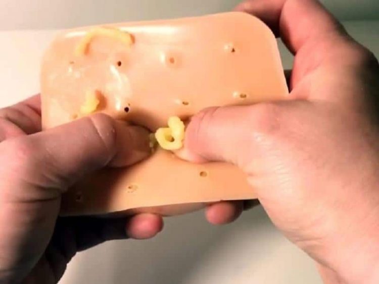 挤黑头挤痘痘神奇工具,用挤痘痘工具挤黑头