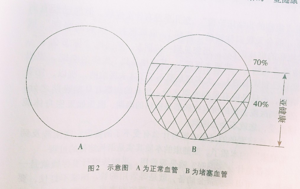 你以为的亚健康其实已病得不轻,重新认识亚健康