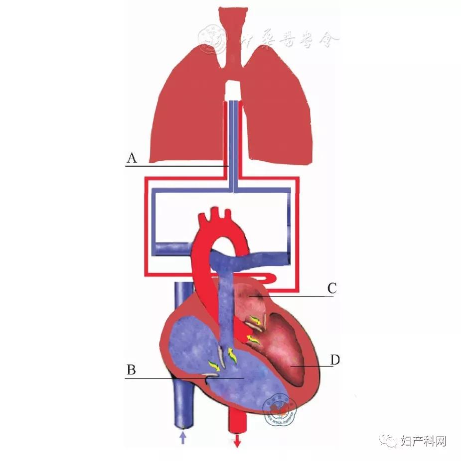羊水栓塞诊疗规范2018,羊水栓塞诊断方法