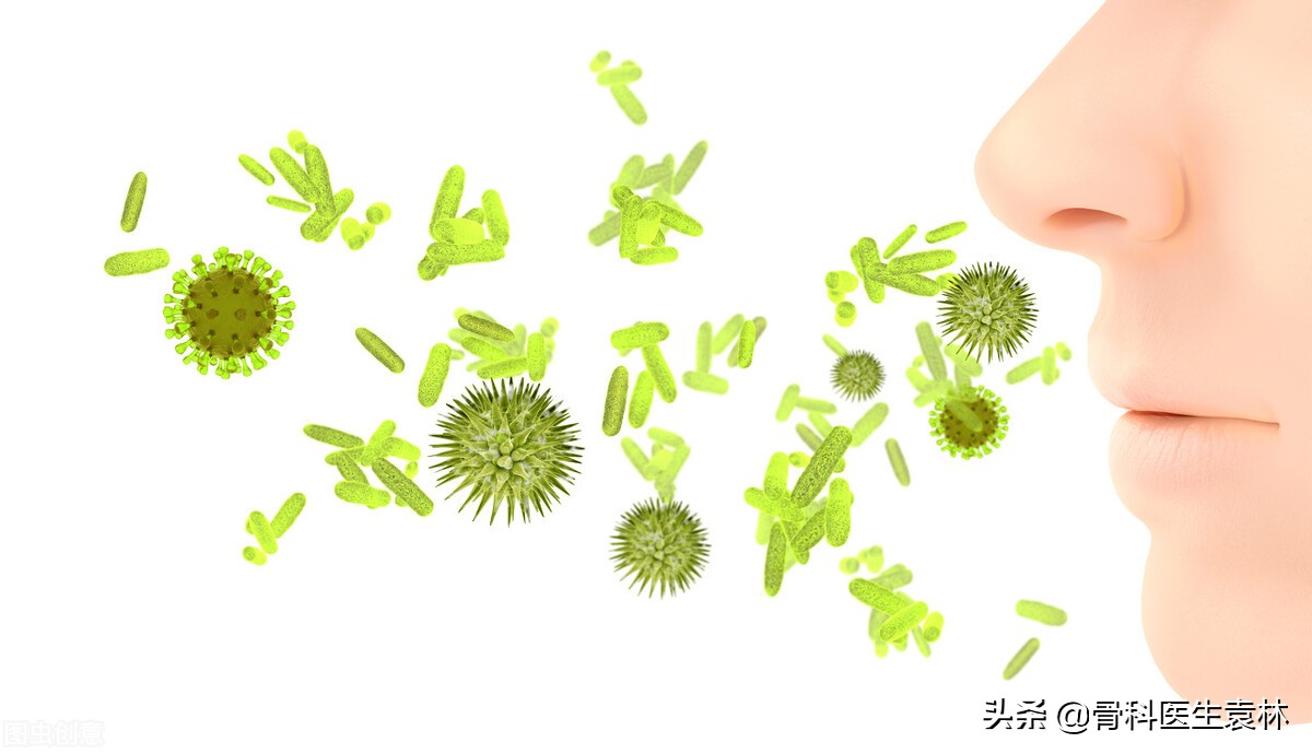 髋关节滑膜炎的症状表现是什么,髋关节滑膜炎严重了是什么症状