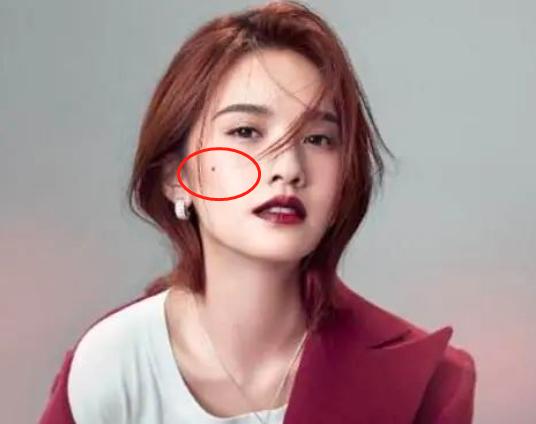 孩子脸上长“痣”别轻易点掉，长对了位置，是天生美人胚子