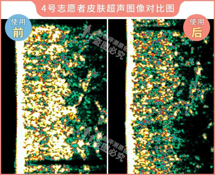 测评家用美容仪真的有用吗,网红推荐的美容仪有用吗