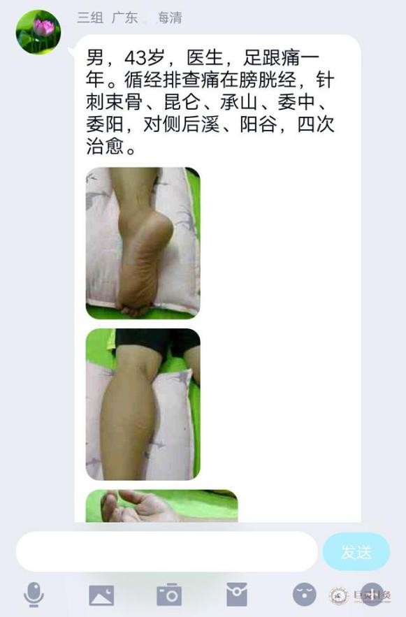 足跟痛是肾阴虚还是阳虚如何判断,气血不足会导致足跟痛吗