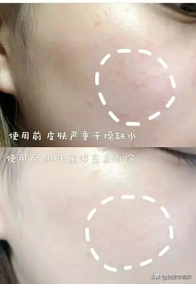 冬天脸干，连皱纹都出来了？日本女博士教你一招，抹几下白白嫩嫩