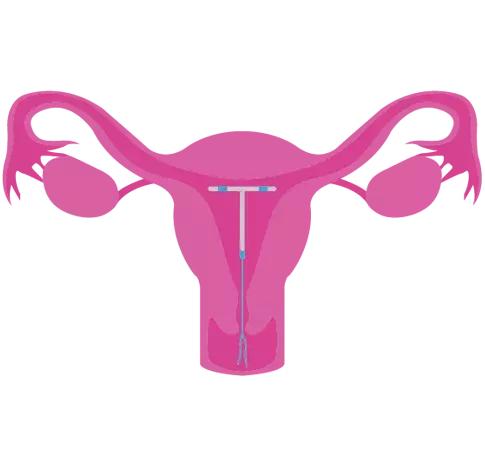 全球首款男性避孕药要来了,男用避孕药研发成功了吗