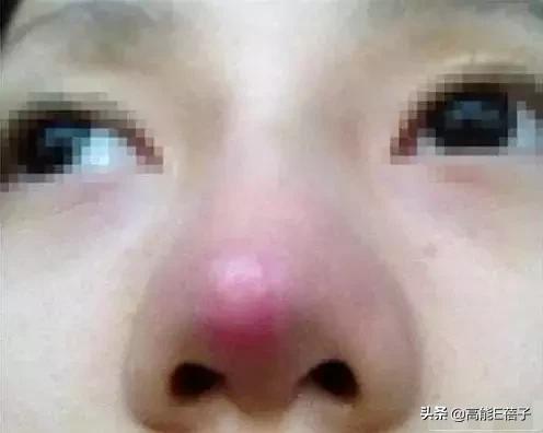 微整形需要多久,最受欢迎的5大微整形