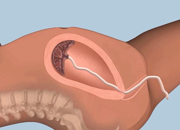 生完孩子医生又把手伸进去，产妇愤怒质问，医生沉稳回答：为你好