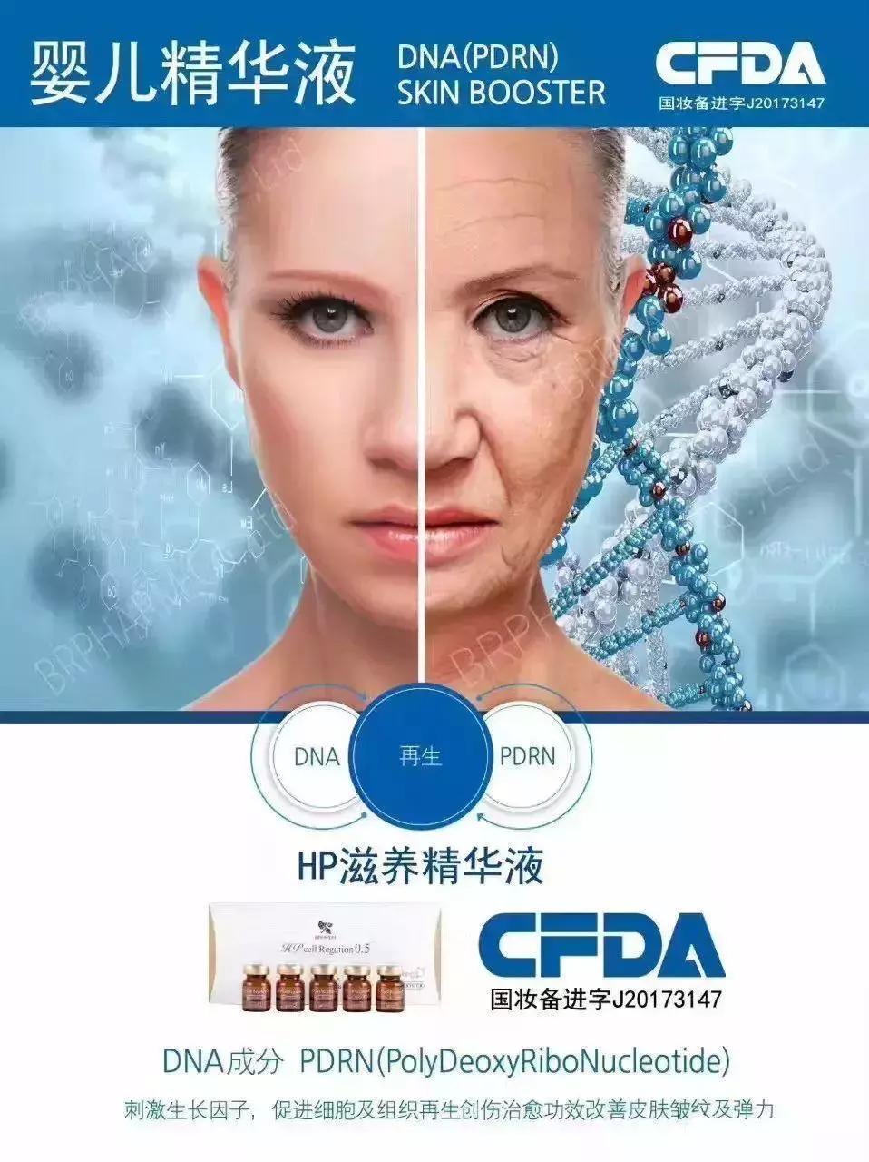 爱马仕轻医美,医美中的爱马仕你知道的有几个