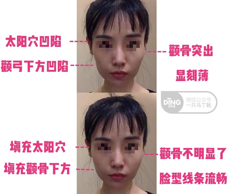 整容最成功的美人,整容最成功的13个人