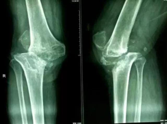 mri临床医师必读电子书,临床医生如何读mri