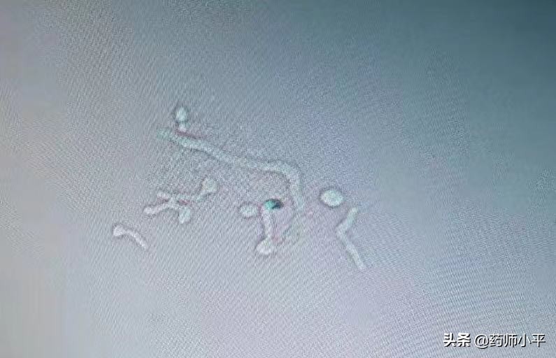 外阴瘙痒说是皮肤病变,外阴瘙痒念珠菌感染是什么引起的