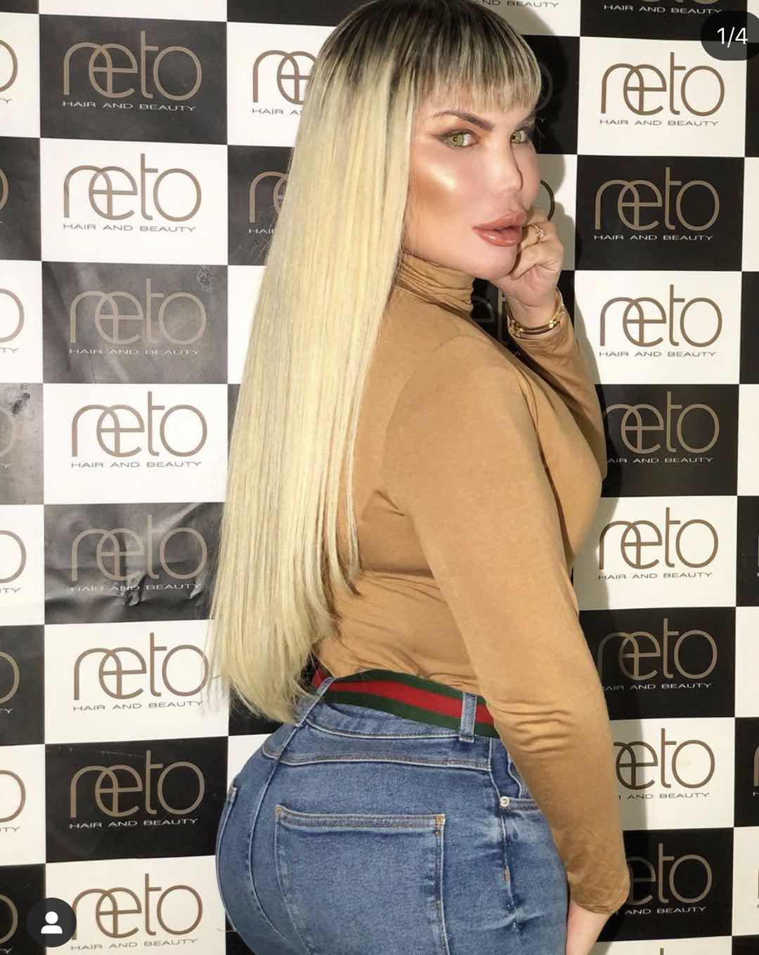 巴西男整容42次图片,巴西男模花数百万整容