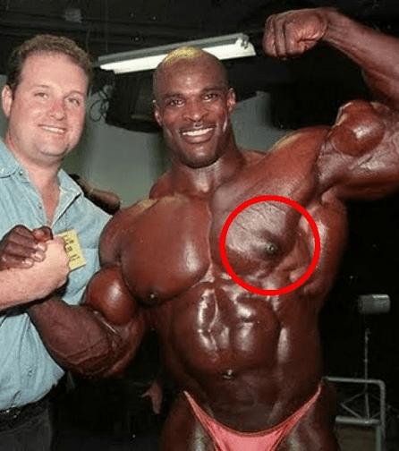 7位顶尖健美运动员，承认在健美生涯中使用过类固醇