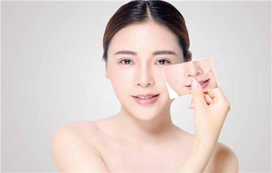 角质层薄怎么修复增厚最快的方法,角质层薄怎么修复日常护理小妙招