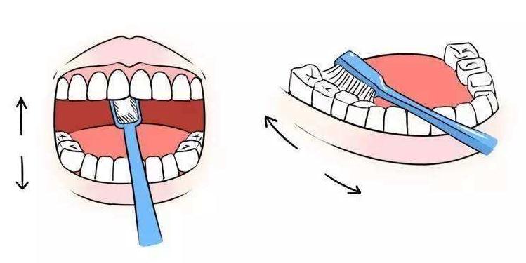 不洗牙去除牙结石的实用方法,牙结石特别严重如何洗牙