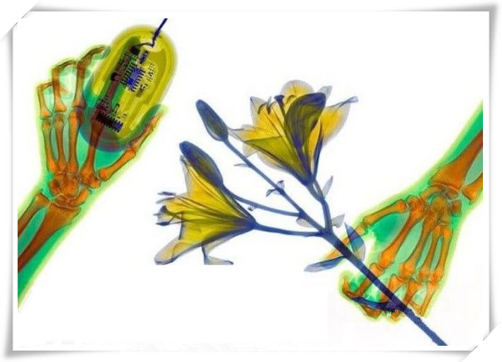 握手、亲吻、喝水、高跟鞋！X射线下人体的样子是啥样？